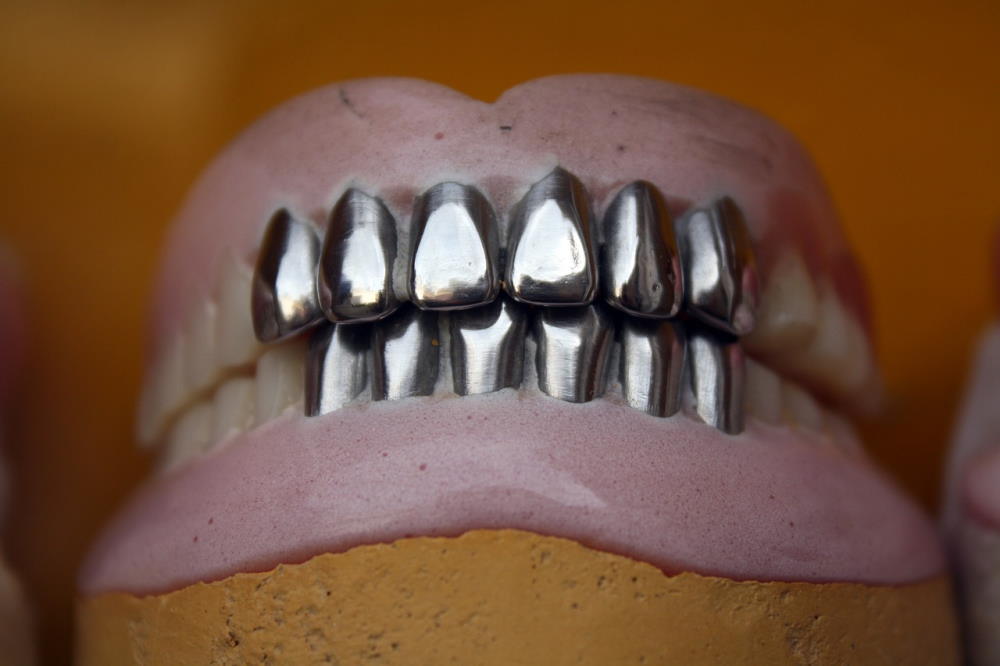 teeth implants